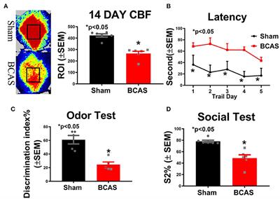 Cardiac Dysfunction in a Mouse Vascular Dementia Model of Bilateral Common Carotid Artery Stenosis